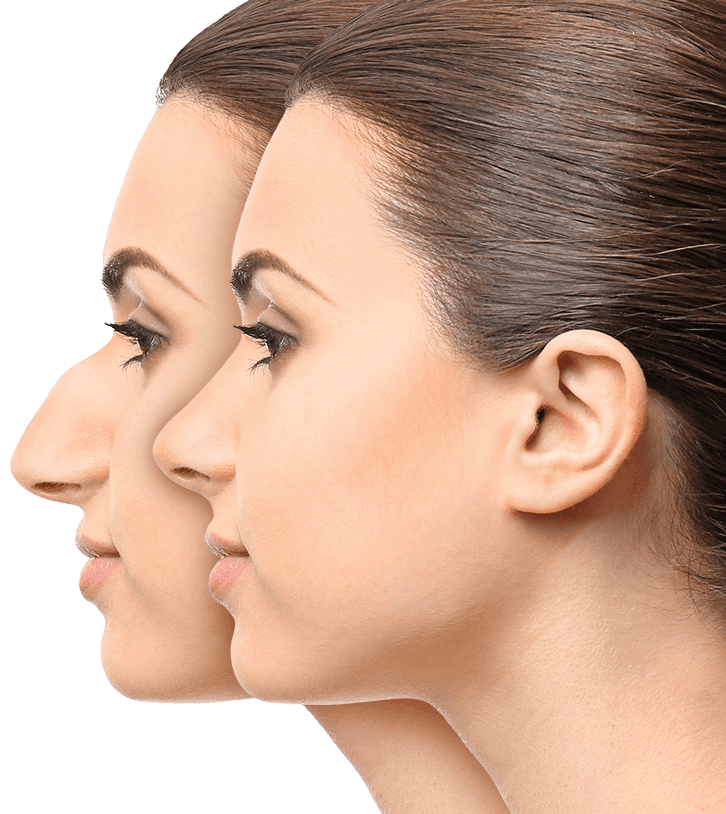 photo-douleur-rhinoplastie-douleur