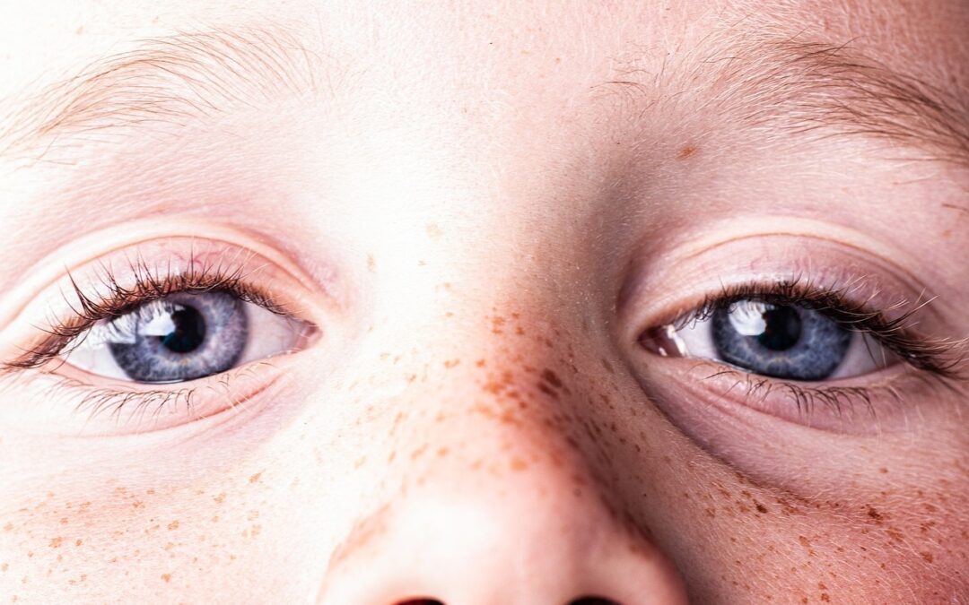 Comment se débarrasser des cicatrices de rhinoplastie ?